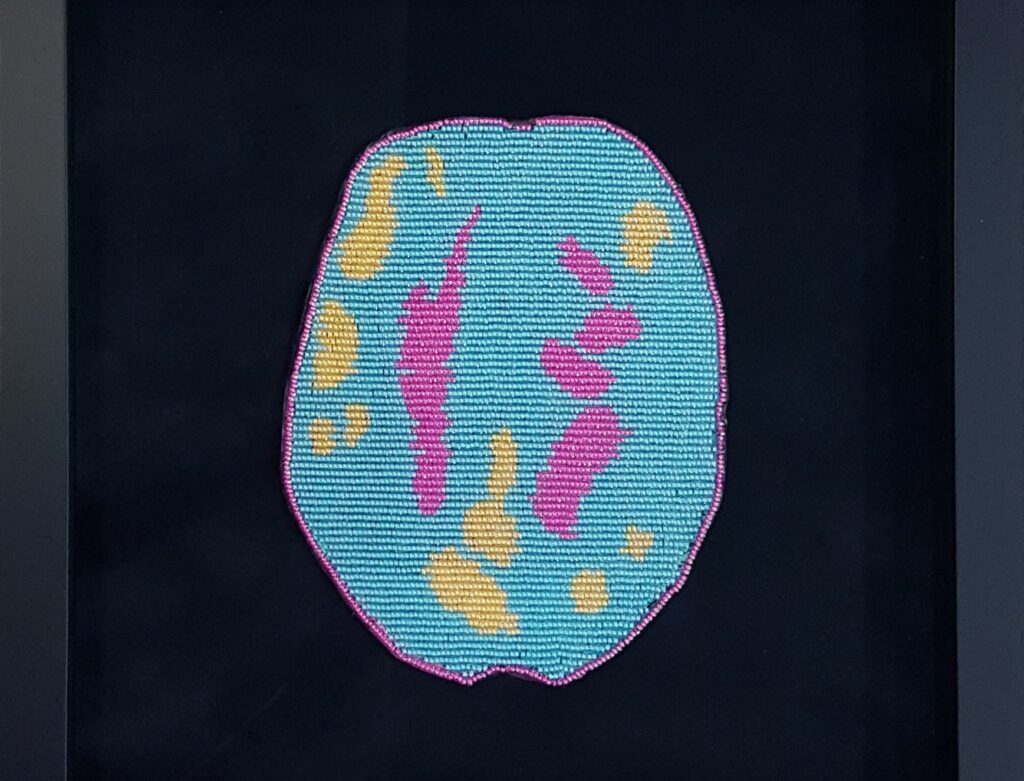 12 Art Exhibitions to Discover in Canada this Summer